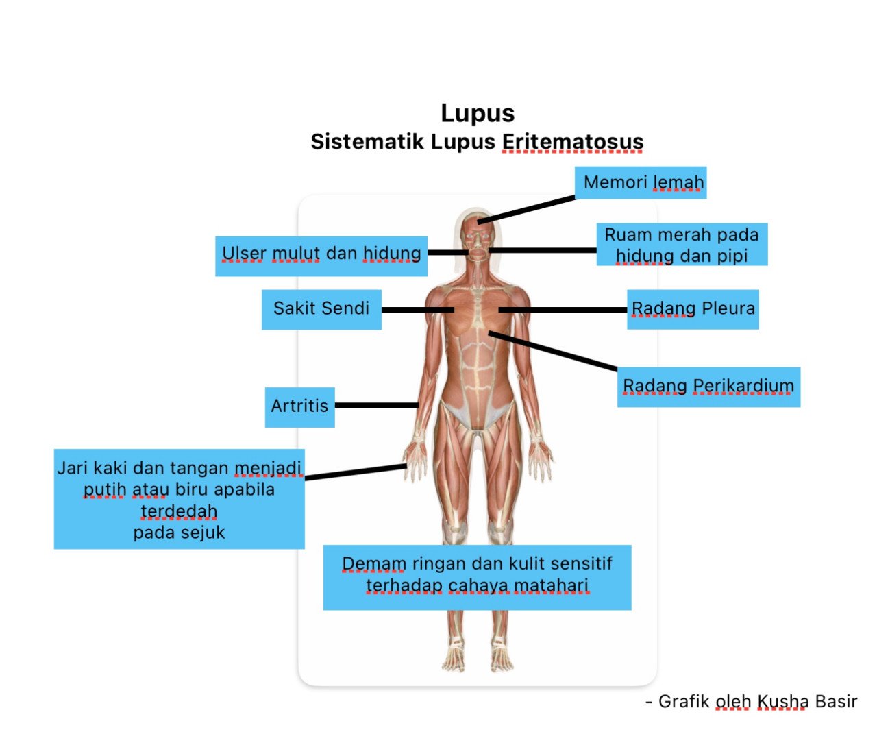  Simptom penyakit lupus