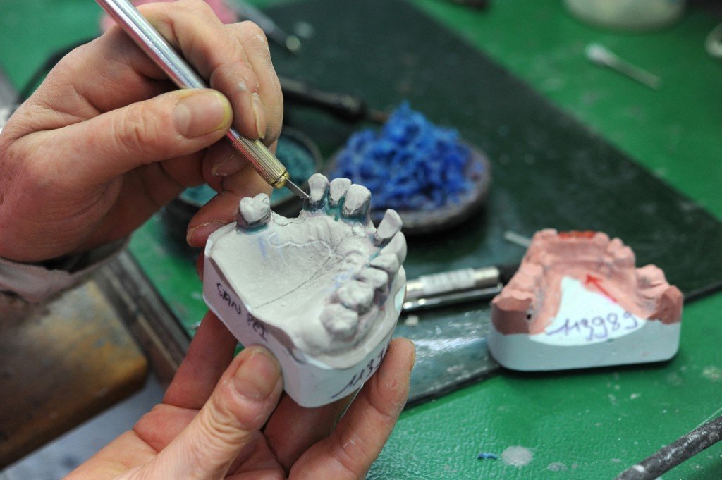 Pembuatan gigi palsu. -  Gambar hiasan AFP